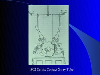 1902 Cervix Contact X-ray Tube
 