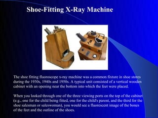 Shoe-Fitting X-Ray Machine




The shoe fitting fluoroscope x-ray machine was a common fixture in shoe stores
during the 1930s, 1940s and 1950s. A typical unit consisted of a vertical wooden
cabinet with an opening near the bottom into which the feet were placed.

When you looked through one of the three viewing ports on the top of the cabinet
(e.g., one for the child being fitted, one for the child's parent, and the third for the
shoe salesman or saleswoman), you would see a fluorescent image of the bones
of the feet and the outline of the shoes.
 