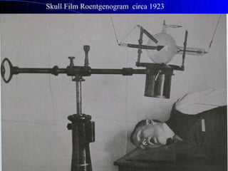 Skull Film Roentgenogram circa 1923
 