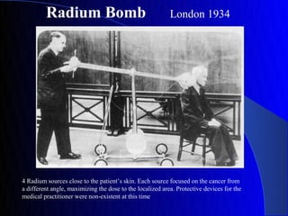 Radium Bomb                                       London 1934




4 Radium sources close to the patient’s skin. Each source focused on the cancer from
a different angle, maximizing the dose to the localized area. Protective devices for the
medical practitioner were non-existent at this time
 