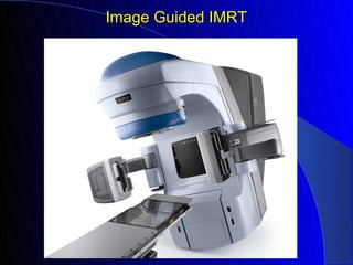 Image Guided IMRT
 