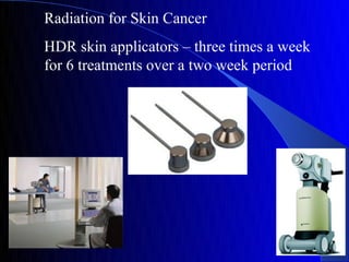 Radiation for Skin Cancer
HDR skin applicators – three times a week
for 6 treatments over a two week period
 