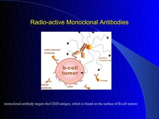 Radio-active Monoclonal Antibodies




monoclonal antibody targets the CD20 antigen, which is found on the surface of B-cell tumors
 