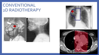 Evolution of RT in Modern Medicine.pptx