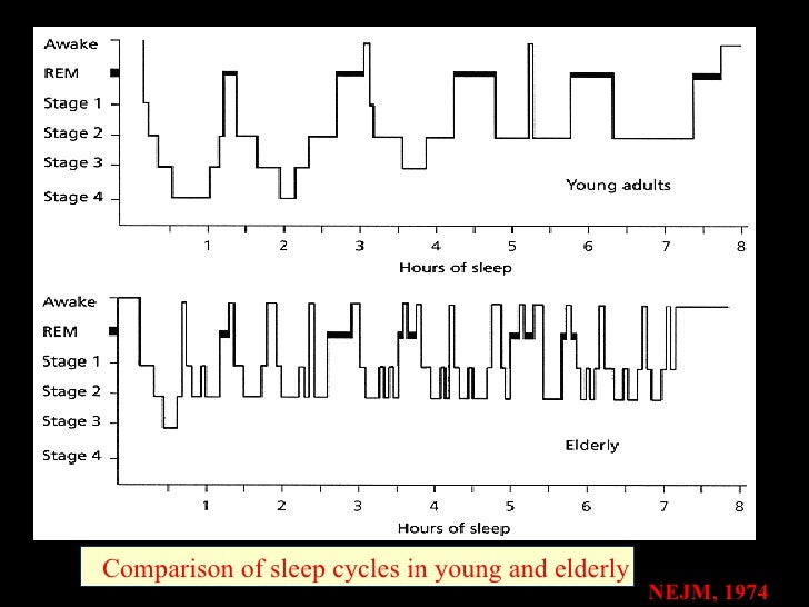 Evolution of sleep