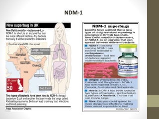NDM-1
