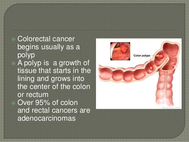 Evolution of surgery in colorectal cancer