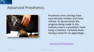 Advanced Prosthetics
Advanced Prosthetics
Prosthetic arms and legs have
now become nimbler and more
refined. To demonstrate the
progress being made in this
industry, here's a prosthetic hand
tying a shoelace. Certainly beats
having a hook for an appendage.
2015-02-25 Evolution of Technology 25
 