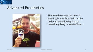 Advanced Prosthetics
The prosthetic eye this man is
wearing is also fitted with an in-
built camera allowing him to
record anything in front of him.
2015-02-25 Evolution of Technology 26
 