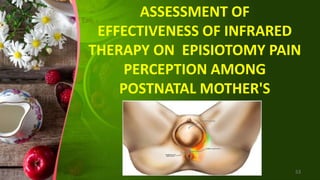 ASSESSMENT OF
EFFECTIVENESS OF INFRARED
THERAPY ON EPISIOTOMY PAIN
PERCEPTION AMONG
POSTNATAL MOTHER'S
53
 