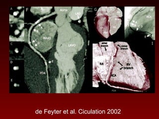121 non invasive imaging of coronary arteries | PPT