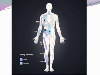 1




            8
 10%




            12
3%               6




       22
       %




       11%



     F - 9%
 
