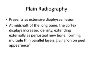 Plain Radiography
• Presents as extensive diaphyseal lesion
• At midshaft of the long bone, the cortex
displays increased density, extending
externally as periosteal new bone, forming
multiple thin parallel layers giving ‘onion peel
appearence’
 