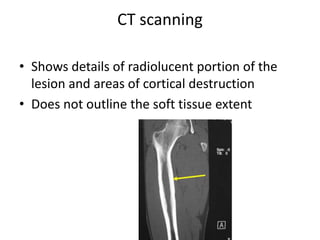 CT scanning
• Shows details of radiolucent portion of the
lesion and areas of cortical destruction
• Does not outline the soft tissue extent
 