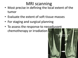 MRI scanning
• Most precise in defining the local extent of the
tumor
• Evaluate the extent of soft tissue masses
• For staging and surgical planning
• To assess the response to neoadjuvant
chemotherapy or irradiation
 