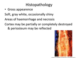 Histopathology
• Gross appearence
Soft, gray white, occasionally shiny
Areas of haemorrhage and necrosis
Cortex may be partially or completely destroyed
& periosteum may be reflected
 
