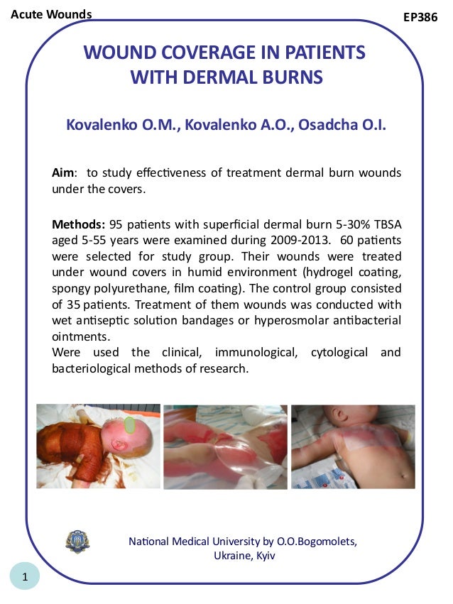 EWMA 2014 EP386 WOUND COVERAGE IN PATIENTS WITH DERMAL BURNS