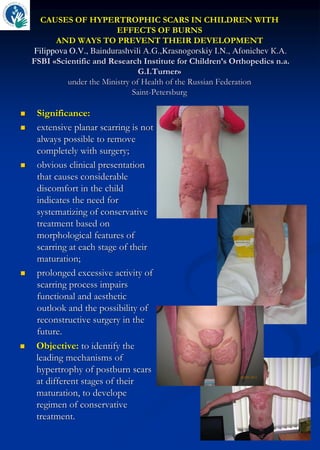 CAUSES OF HYPERTROPHIC SCARS IN CHILDREN WITH
EFFECTS OF BURNS
AND WAYS TO PREVENT THEIR DEVELOPMENT
Filippova O.V., Baindurashvili А.G.,Krasnogorskiy I.N., Afonichev К.А.
FSBI «Scientific and Research Institute for Children’s Orthopedics n.a.
G.I.Turner»
under the Ministry of Health of the Russian Federation
Saint-Petersburg
 Significance:
 extensive planar scarring is not
always possible to remove
completely with surgery;
 obvious clinical presentation
that causes considerable
discomfort in the child
indicates the need for
systematizing of conservative
treatment based on
morphological features of
scarring at each stage of their
maturation;
 prolonged excessive activity of
scarring process impairs
functional and aesthetic
outlook and the possibility of
reconstructive surgery in the
future.
 Objective: to identify the
leading mechanisms of
hypertrophy of postburn scars
at different stages of their
maturation, to develope
regimen of conservative
treatment.
 