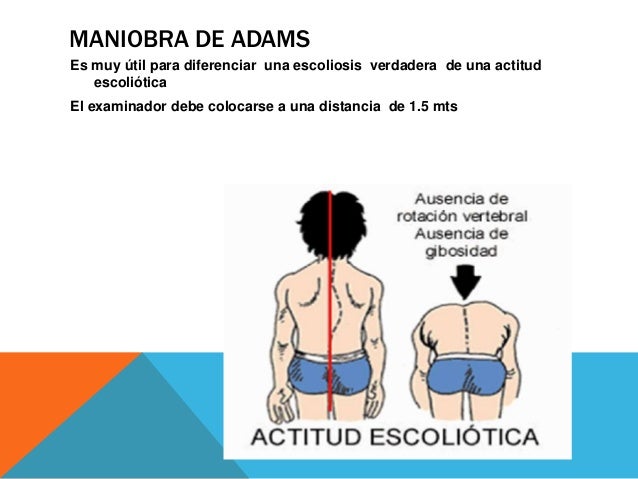 Exploración física de la columna