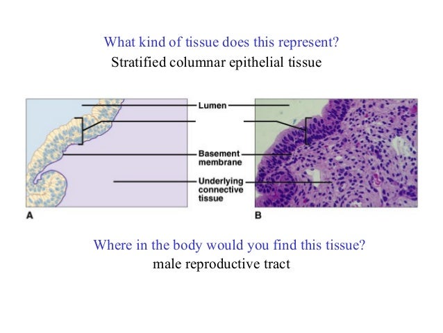 What is transitional epithelium picture