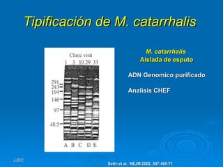 Tipificación de M. catarrhalis   M. catarrhalis   Aislada de esputo ADN Genomico purificado Analisis CHEF Sethi et al.  NEJM 2002, 347:465-71 