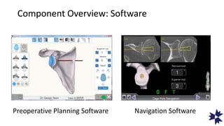 Component Overview: Software
Preoperative Planning Software Navigation Software
 