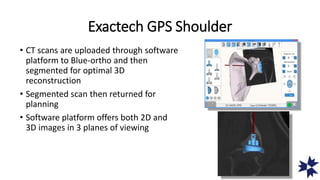 Exactech GPS Shoulder
• CT scans are uploaded through software
platform to Blue-ortho and then
segmented for optimal 3D
reconstruction
• Segmented scan then returned for
planning
• Software platform offers both 2D and
3D images in 3 planes of viewing
 