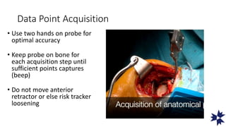 Exactech gps presentation | PPTX