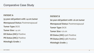 DCIS Topic-Driven Round Table: Decision-Making and Treatment Choices | PPTX