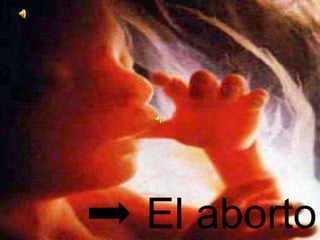 El aborto
 