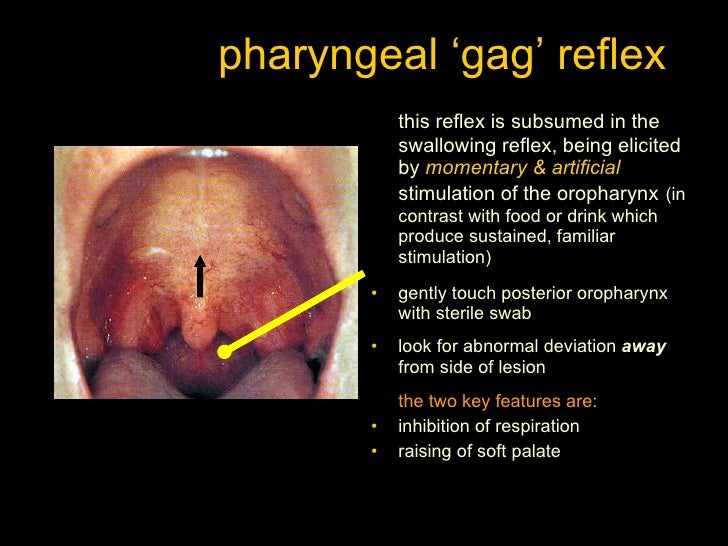 Throat gag reflex cranial nerve - saysv
