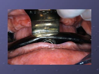 Examination, Diagnosis, Treatment Planing I