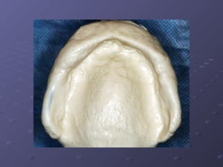 Examination, Diagnosis, Treatment Planing I