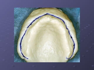 Examination, Diagnosis, Treatment Planing I