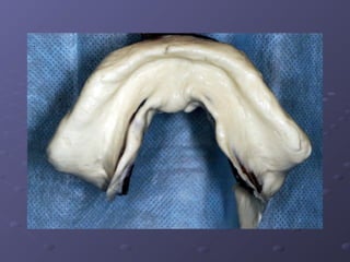 Examination, Diagnosis, Treatment Planing I