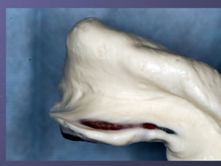 Examination, Diagnosis, Treatment Planing I