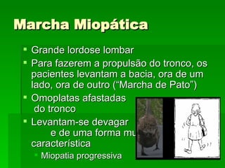 Marcha Miopática Grande lordose lombar Para fazerem a propulsão do tronco, os pacientes levantam a bacia, ora de um lado, ora de outro (“Marcha de Pato”) Omoplatas afastadas  do tronco Levantam-se devagar  e de uma forma muito  característica Miopatia progressiva 