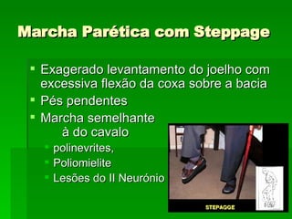 Marcha Parética com Steppage Exagerado levantamento do joelho com excessiva flexão da coxa sobre a bacia Pés pendentes Marcha semelhante  à do cavalo polinevrites,  Poliomielite Lesões do II Neurónio 
