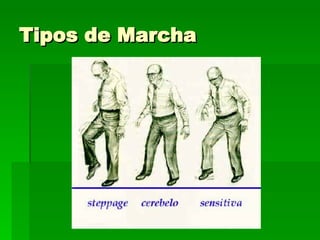 Tipos de Marcha 