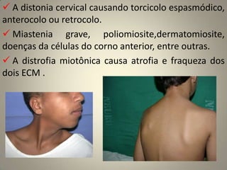 Dois ramos: vestibular e coclearRamo vestibular: percepção corporal originada do labirinto