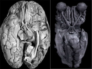 Distúrbios unilaterais de olfato mais preocupantes do que distúrbios bilaterais