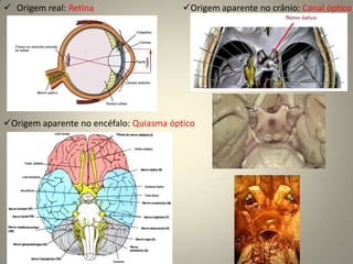 Lesões e síndromes do NC ICausas principais de anosmia: IRS, idiopatias, traumatismos e doenças nasais e dos seios paranasais.