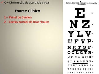 O NC II é dividido em quatro partes:Intra-ocular (1 mm; disco)