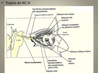 Oficialmente nervo por convençãoA – Comprometimento do campo visual