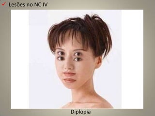  Constrição e contração concêntrica dos campos