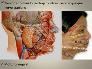 Lesões no NC IV Diplopia