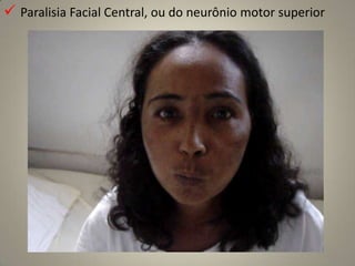 Núcleos: Existem quatro núcleos trigêmeos – um motor e três sensitivos.