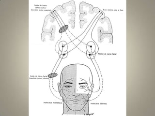  NC V é o principal nervo sensitivo geral para a cabeça