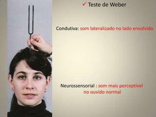 Reflexo Esternutatório (Nasal, de Espirro)