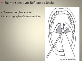  Enquanto atravessa o osso temporal dentro do canal facial, o NC VII dá origem a três ramos.Percorrer o mais longo trajeto intra-ósseo de qualquer  nervo craniano